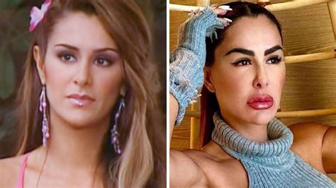 Ninel Conde is Getting Another Surgery